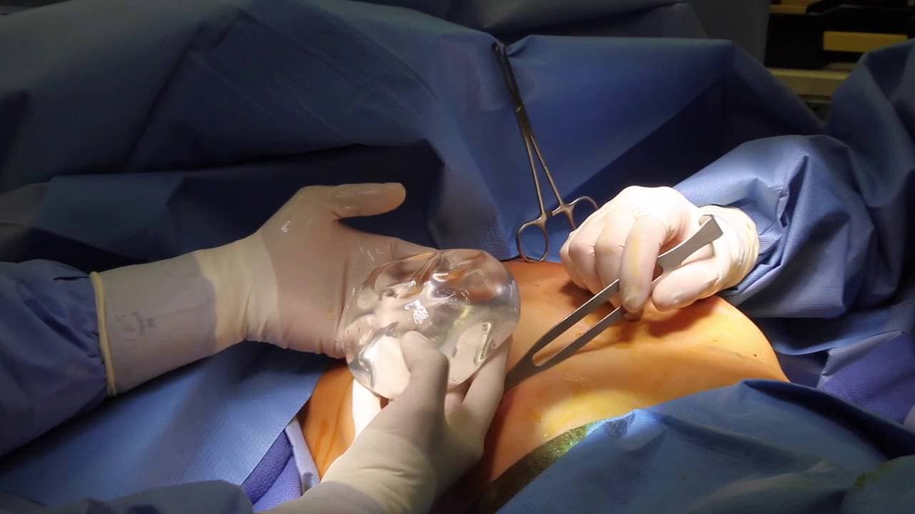 Plastische Chirurgie Bochum: Alles über Brustoperationen und Körperformung